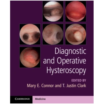 Diagnostic and Operative Hysteroscopy Mary Connor