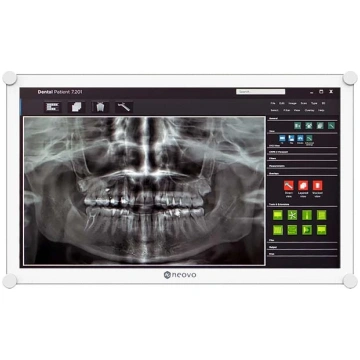 AG Neovo DR-2202 datora monitors 54,6 cm (21,5 col